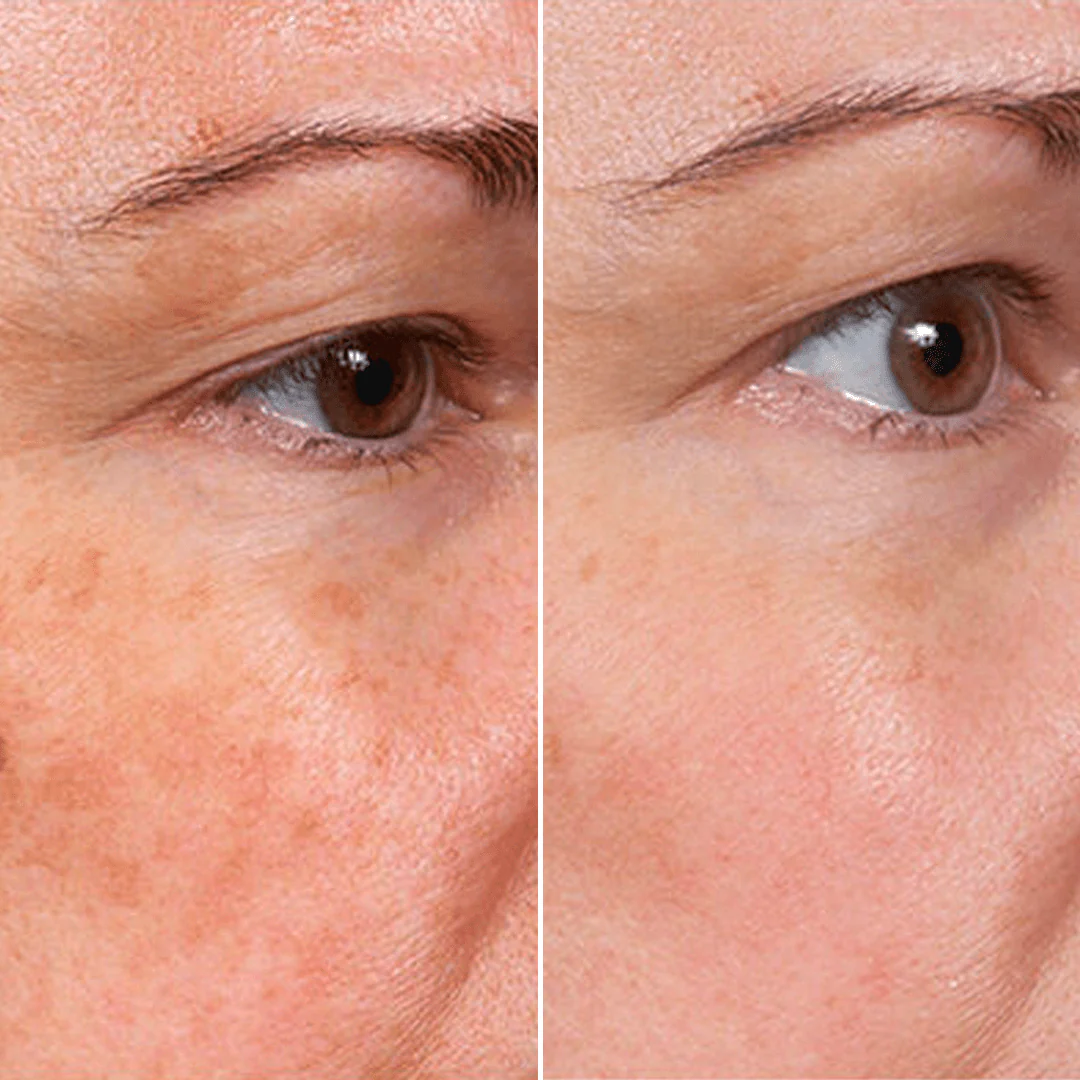 【𝐿𝑎𝑠𝑡 𝐷𝑎𝑦 𝑃𝑟𝑜𝑚𝑜𝑡𝑖𝑜𝑛 70% 𝑂𝐹𝐹】𝑷𝒖𝒓𝒆𝒍𝒖𝒙𝒐® Stem Cell–Inspired & GHK-Cu Powered Wrinkle-Refining Serum（Advanced Anti-Aging for Timeless, Radiant Skin） - Image 8