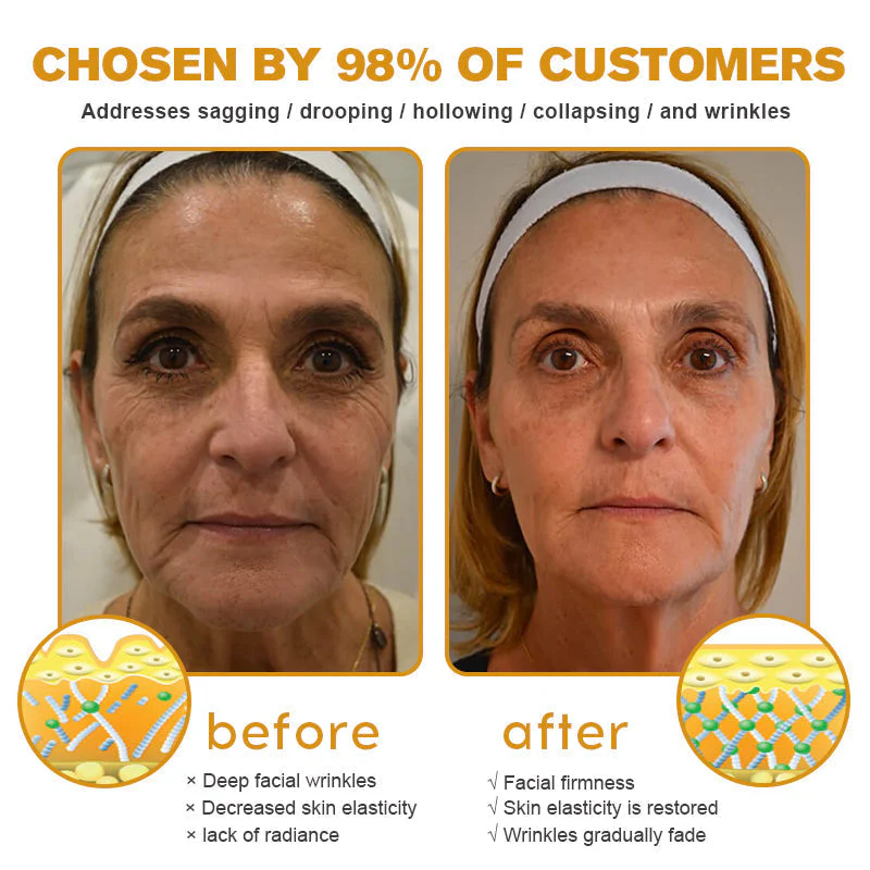 Official US Store 🇺🇸| Pureluxo® Advanced Skin Cream Daily Skin Care - Image 4